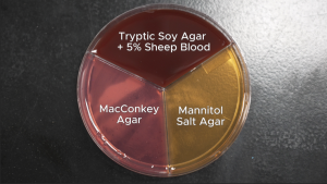 Artificial Intelligence AI pathogen identification Intelligence artificielle IA identification de pathogènes Microselect Petri Dish triple