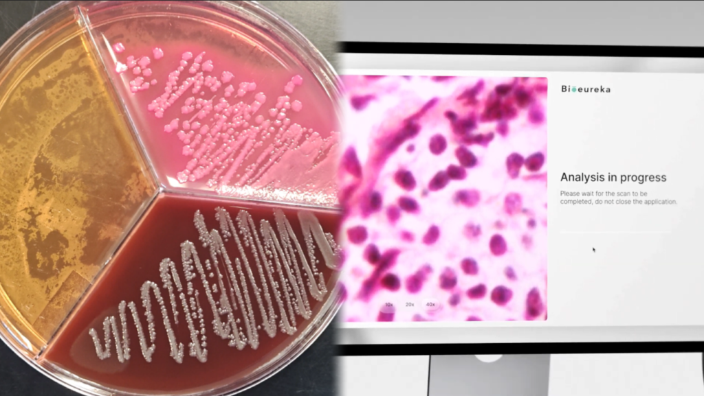 Discover MicroSelect: The Revolution in Pathogen Identification in Laboratories and the Food Industry